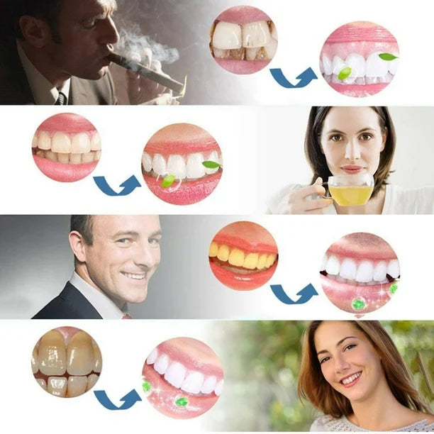 Teeth Whitening Stripes