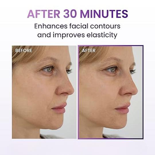 3D Face Lifting Mask