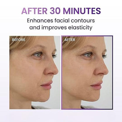 3D Face Lifting Mask