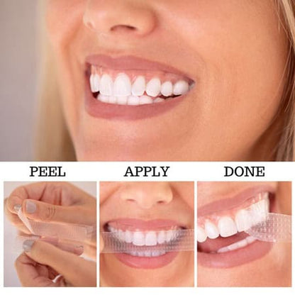 Teeth Whitening Stripes